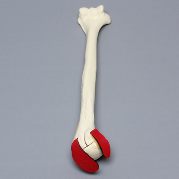 Humerus with Five-Part Head Fracture and Ligaments, Foam Cortical