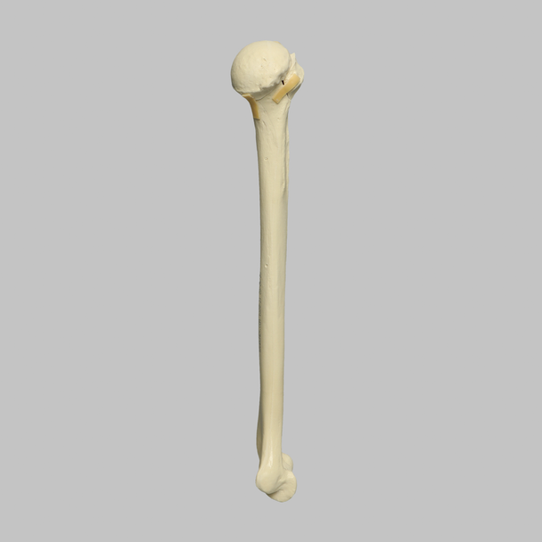 Humerus with Four-Part Bicipital Groove Fracture, Foam Cortical, Left
