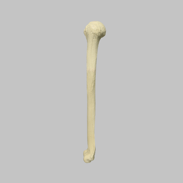 Humerus with Open Proximal Canal, Foam Cortical