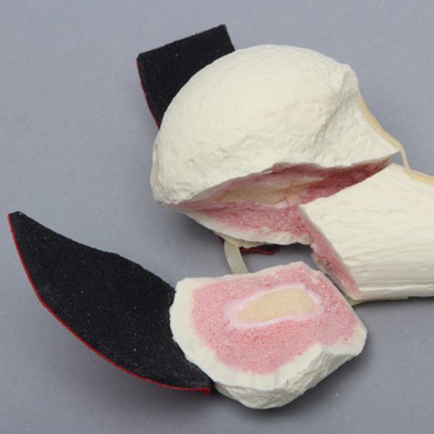 Humerus with Three-Part Head Fracture and Tendon, Foam Cortical