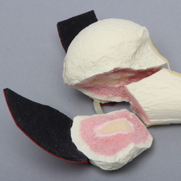Humerus with Three-Part Head Fracture and Tendon, Foam Cortical