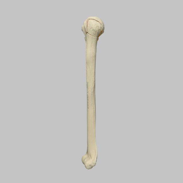 Humerus with Four-Part Head Fracture, Foam Cortical