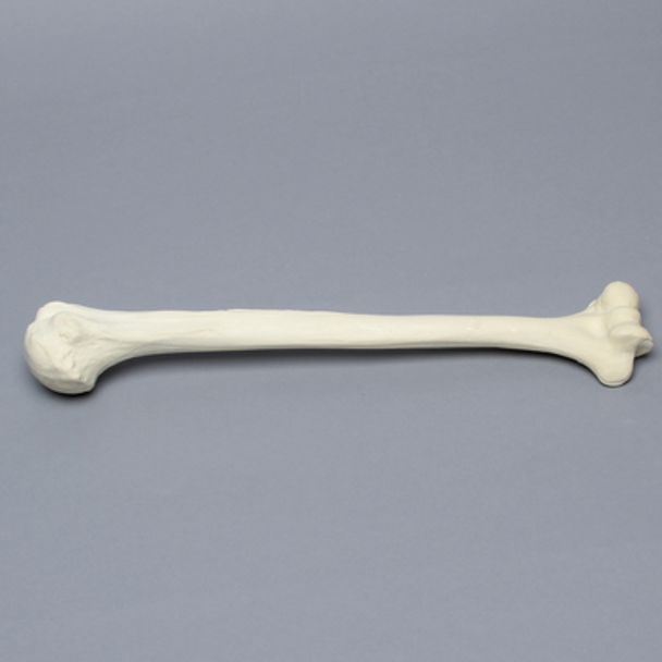 Humerus, Osteoporotic, Foam Cortical