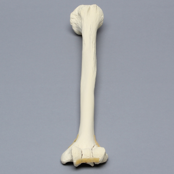 Humerus with "Y" Fracture, Foam Cortical