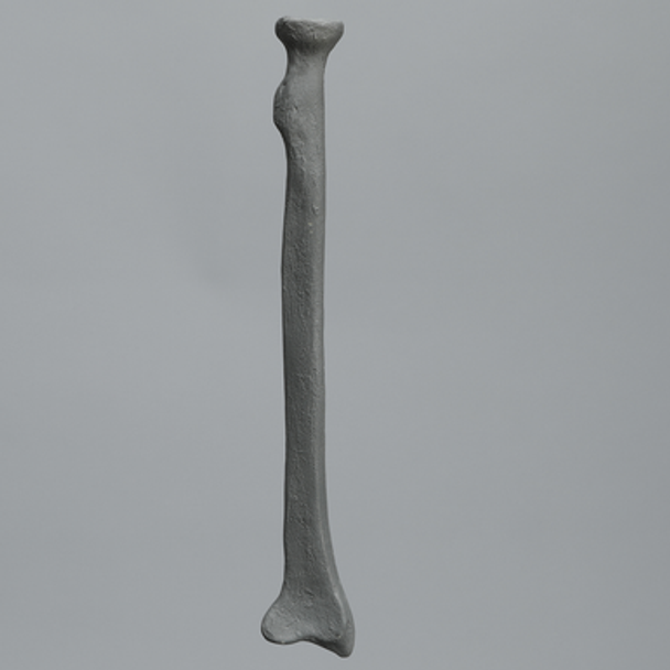 Radius, Radiopaque, Left