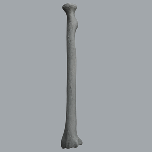 Radius, Radiopaque, Left