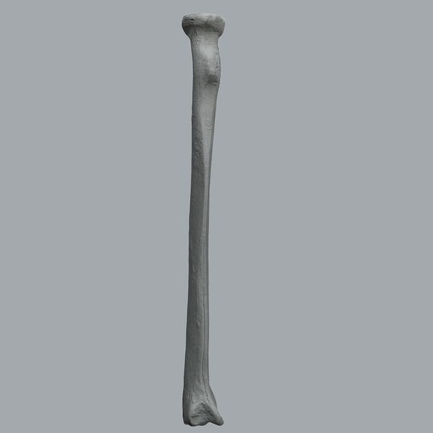 Radius, Radiopaque, Left