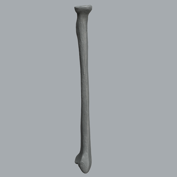 Radius, Radiopaque, Left