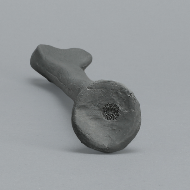 Radius, Radiopaque, Left