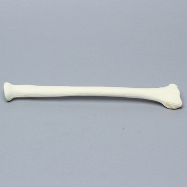 Radius with Fracture for Volar Plate, Foam Cortical