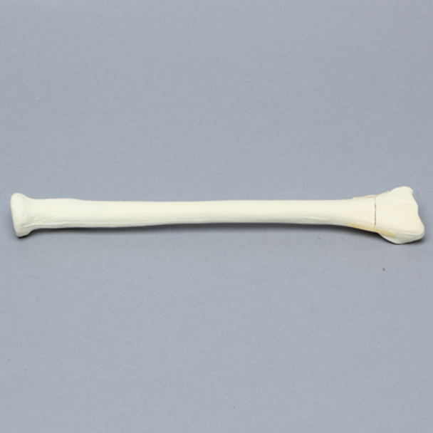 Radius with Four-Part Fracture, Foam Cortical