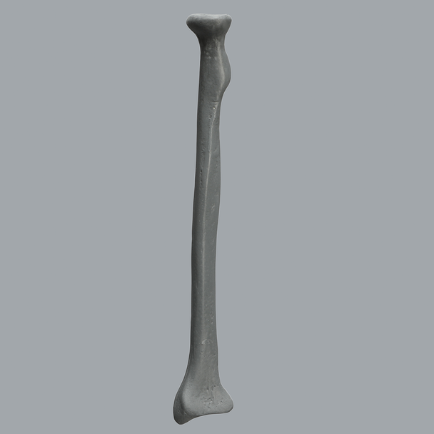 Radius, Radiopaque, Right