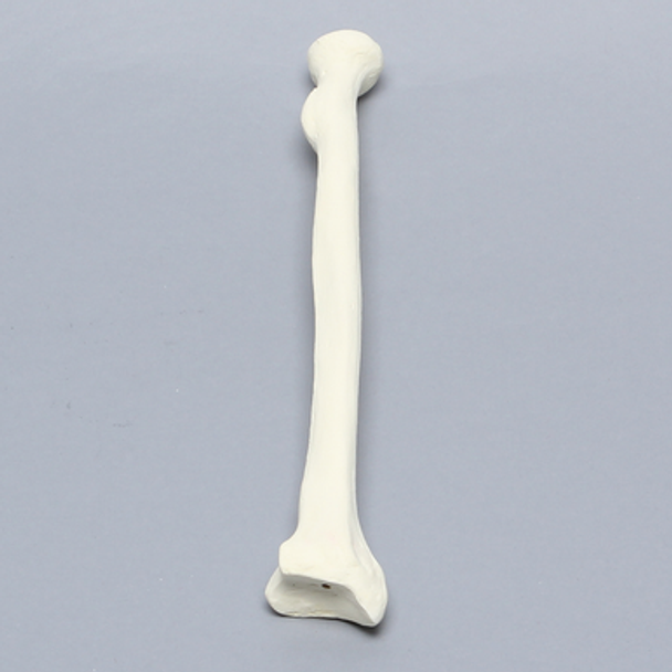 Radius, 5.5mm Canal, Foam Cortical Shell, Right