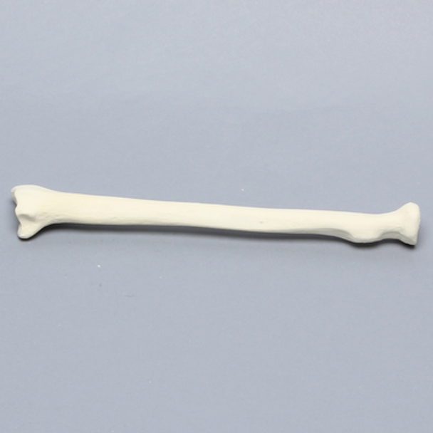 Radius, 5.5mm Canal, Foam Cortical, Left