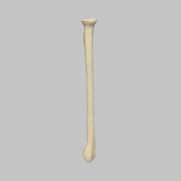 Radius, 5.5mm Canal, Foam Cortical, Left