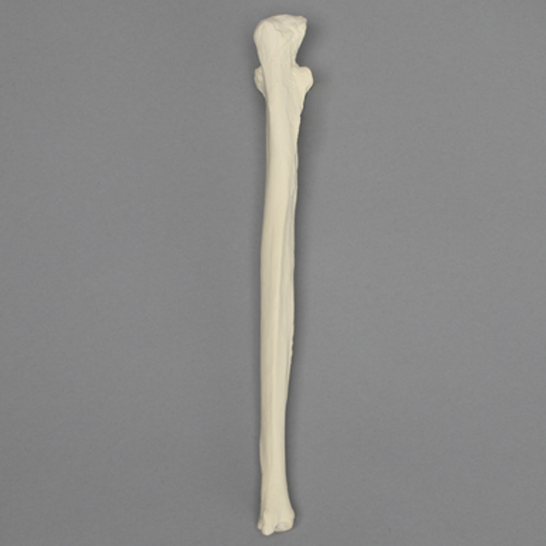 Ulna, 5mm Canal, Foam Cortical Shell, Right