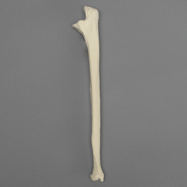 Ulna, 5mm Canal, Foam Cortical Shell, Right