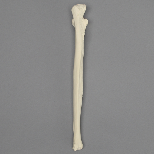 Ulna, 5mm Canal, Foam Cortical Shell, Right