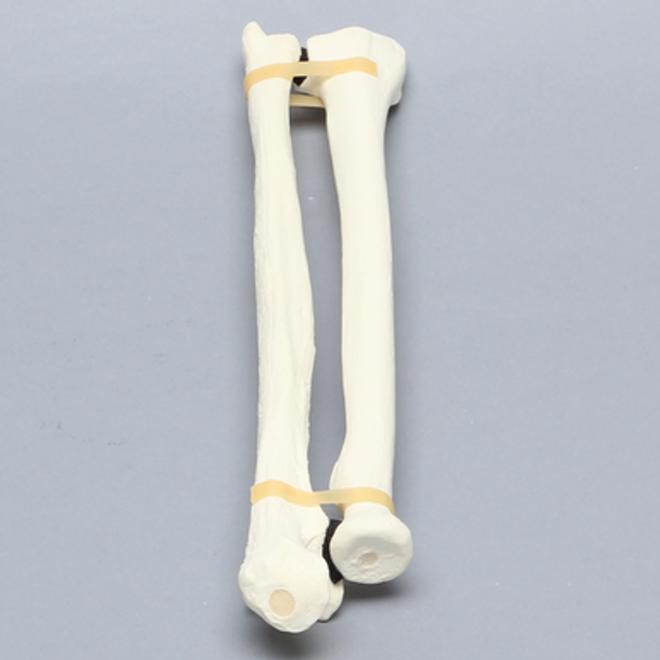 Ulna and Radius, Foam Cortical