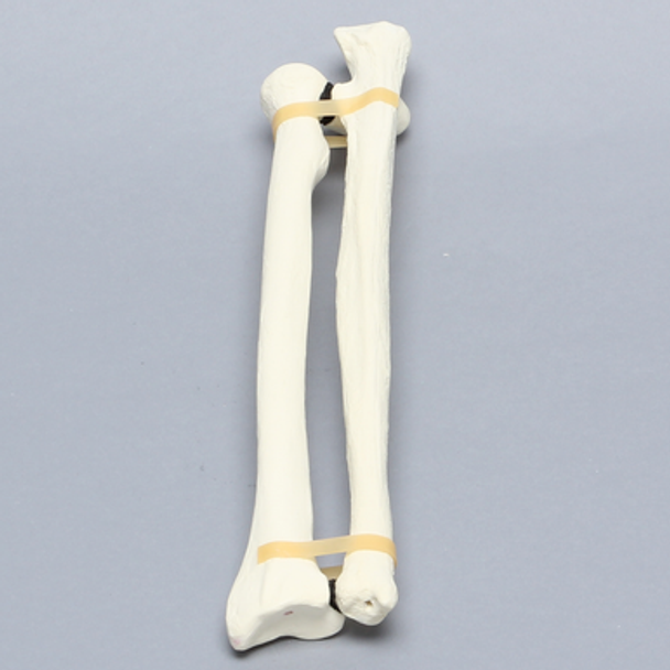 Ulna and Radius, Foam Cortical