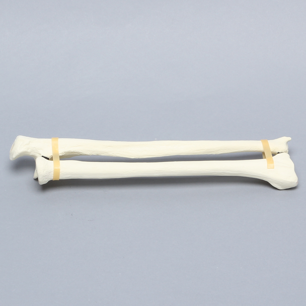 Ulna and Radius, Foam Cortical