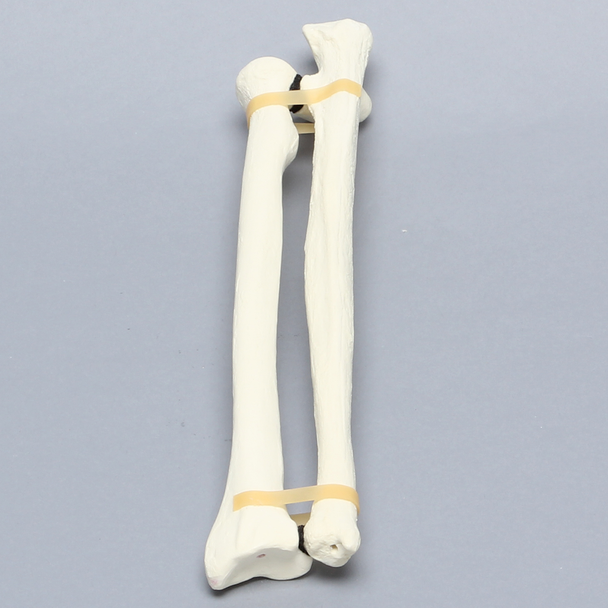 Ulna and Radius, Foam Cortical