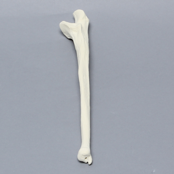 Ulna, 5mm Canal, Foam Cortical Shell, Left