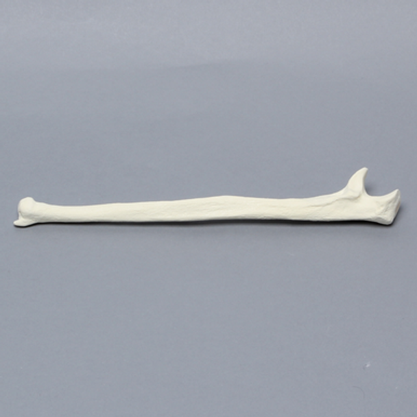 Ulna, 5mm Canal, Foam Cortical Shell, Left