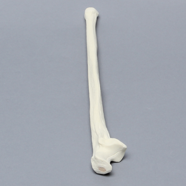 Ulna, 5mm Canal, Foam Cortical Shell, Left