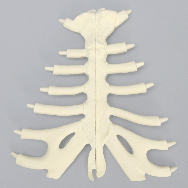 Sternum, Split Set, Solid Foam