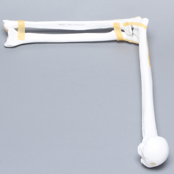 Elbow with Latex Ligament, Plastic Cortical Shell