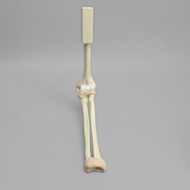 Arthroscopy Elbow Insert with Capsule and Cartilage