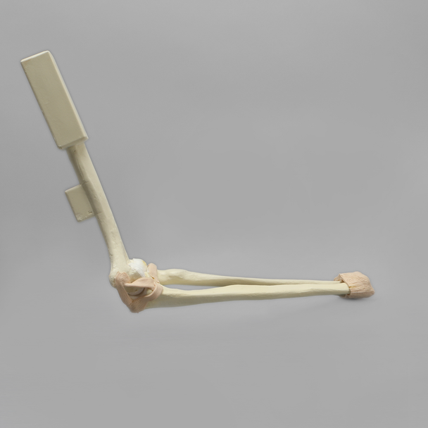 Arthroscopy Elbow Insert with Capsule and Cartilage