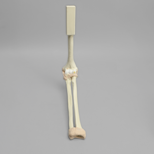Arthroscopy Elbow Insert with Capsule and Cartilage