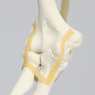 Arm, Solid Foam, Right