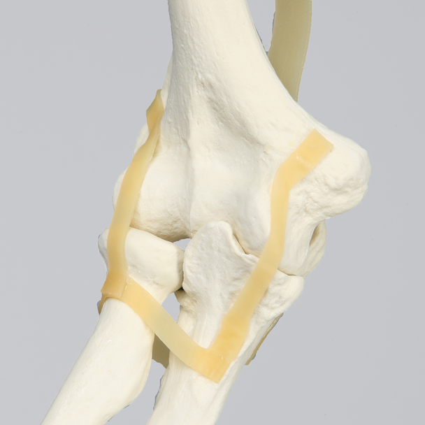 Arm, Solid Foam, Right