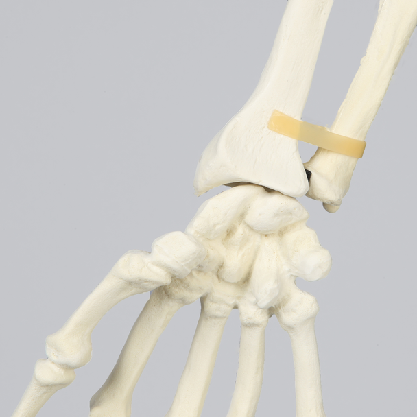 Arm, Solid Foam, Right