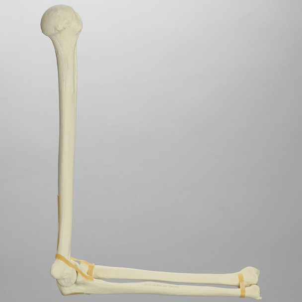 Elbow, Foam Cortical Shell, Left