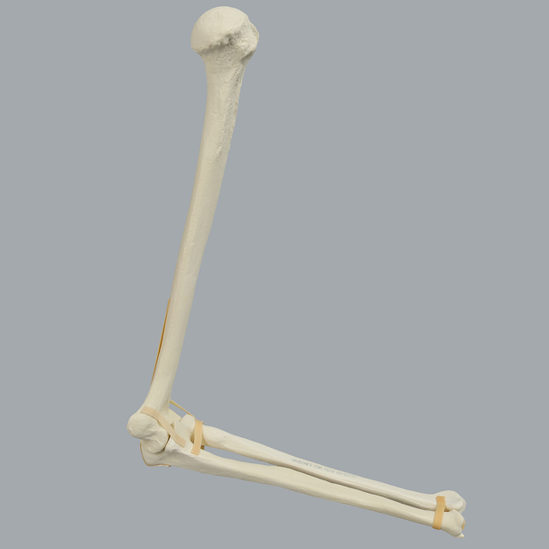 Elbow with Foam Cortical Humerus & Ulna, Solid Foam Radius