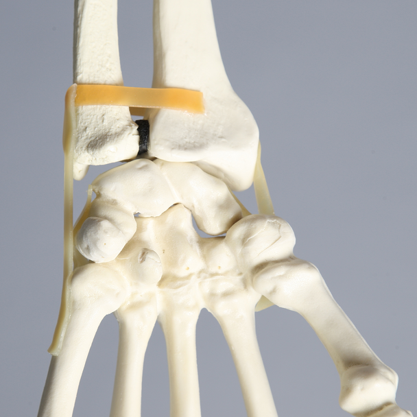 Hand and Wrist with Moveable Carpals, Solid Foam