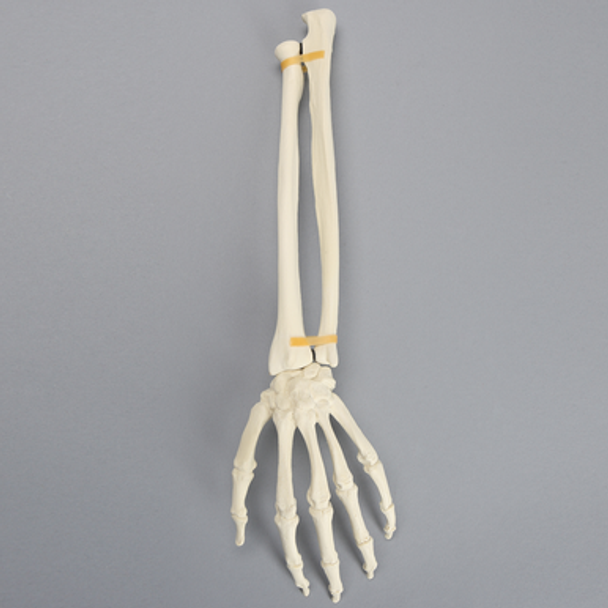 Hand and Wrist without Canal, Solid Foam