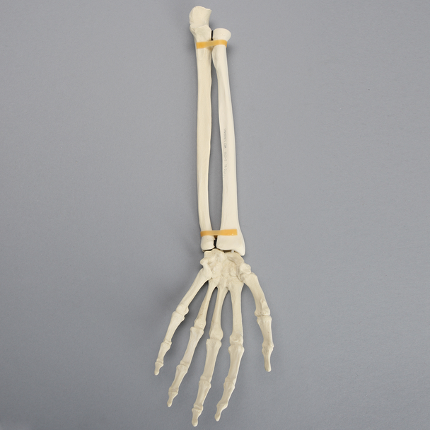 Hand and Wrist without Canal, Solid Foam