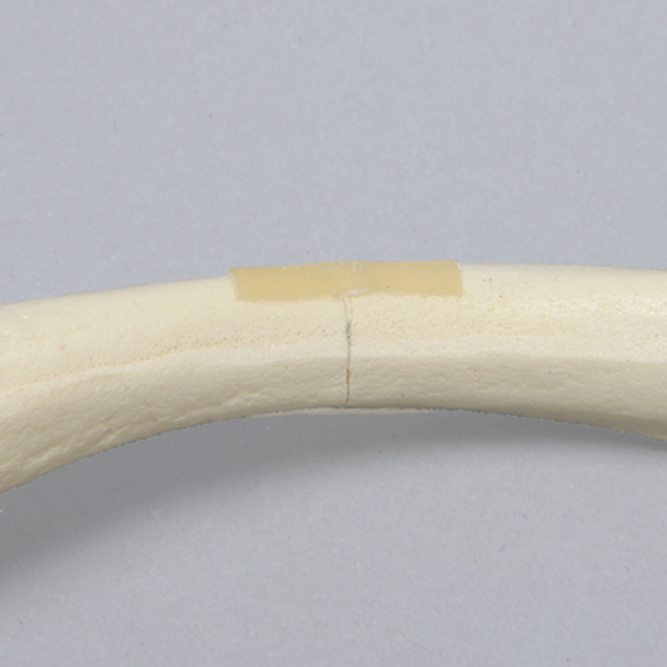 Clavicle with Transverse Fracture, Solid Foam