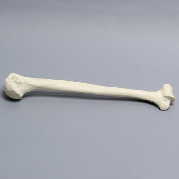 Humerus Unplugged, 9.5mm Canal, Solid Foam