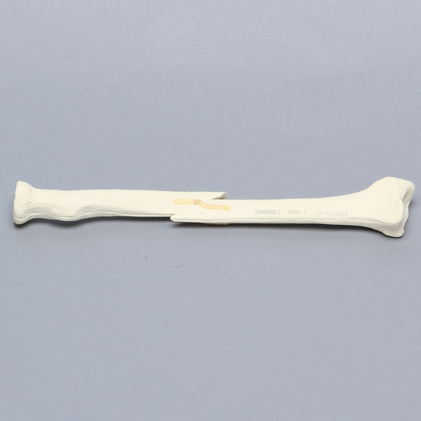 Radius with Short Oblique Fracture, 6.4mm Canal, Solid Foam