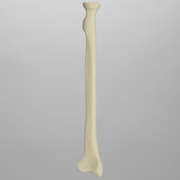 Radius, 6.4mm Canal, Solid Foam, Left