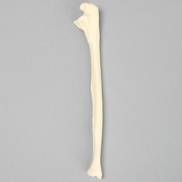 Ulna with Arthritis, Solid Foam, Female