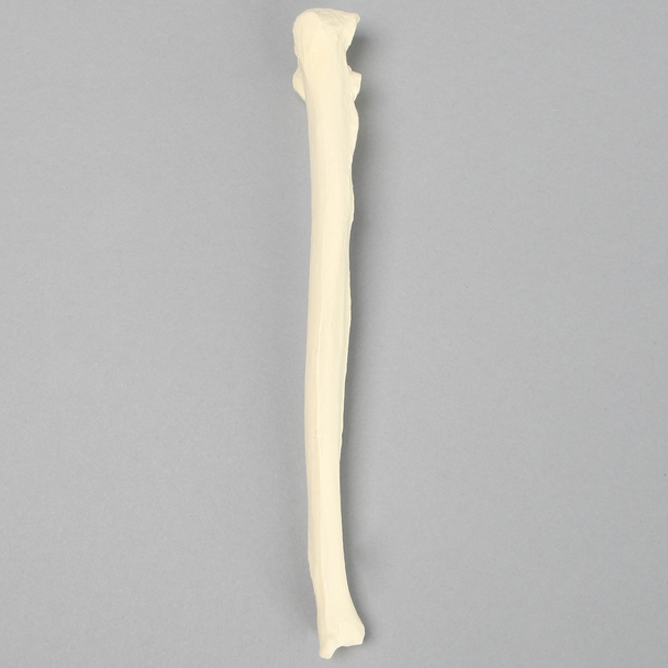 Ulna with Arthritis, Solid Foam, Female