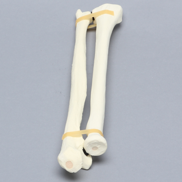 Ulna and Radius, 5.5mm Canal, Solid Foam