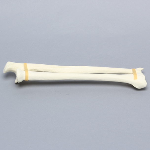 Ulna and Radius, 5.5mm Canal, Solid Foam
